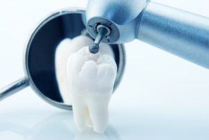 conservativa endodonzia 300x201